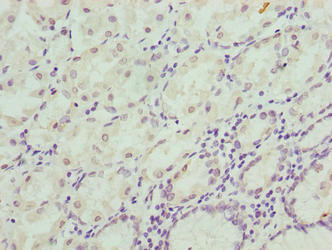CIPC Antibody in Immunohistochemistry (Paraffin) (IHC (P))