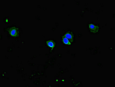 CCDC8 Antibody in Immunocytochemistry (ICC/IF)