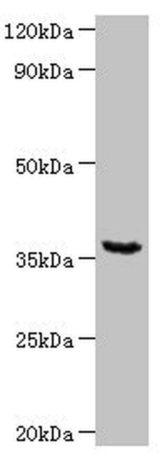 WDR54 Antibody in Western Blot (WB)