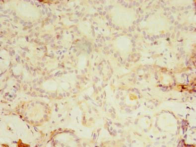 KBTBD4 Antibody in Immunohistochemistry (Paraffin) (IHC (P))