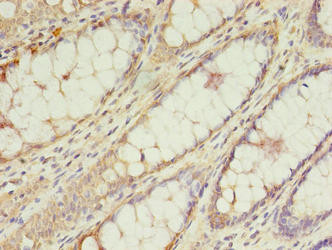 TRSPAP1 Antibody in Immunohistochemistry (Paraffin) (IHC (P))