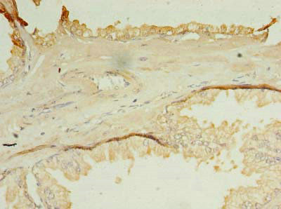 OCIAD1 Antibody in Immunohistochemistry (Paraffin) (IHC (P))