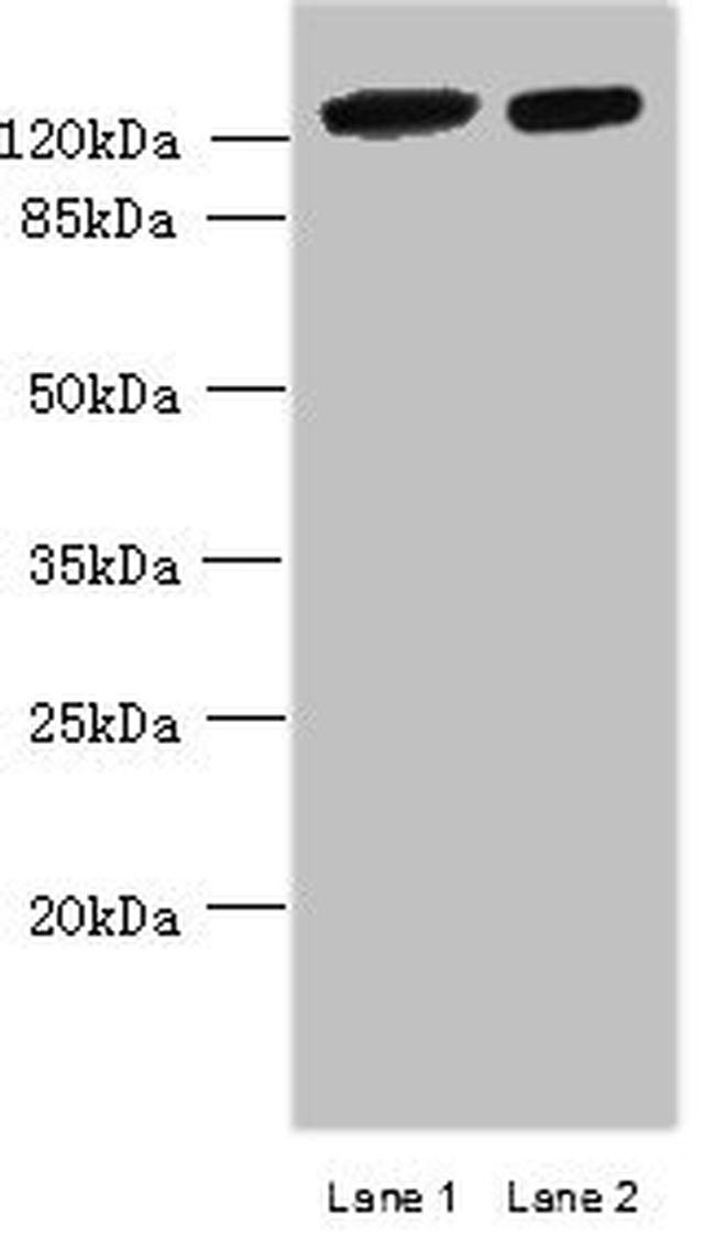 MCM9 Antibody in Western Blot (WB)