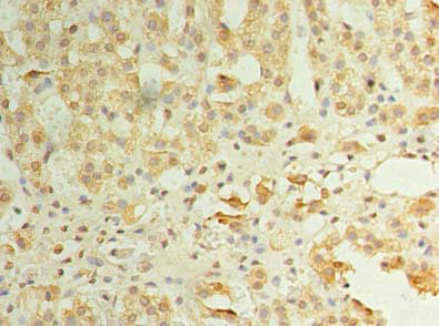 ZDHC3 Antibody in Immunohistochemistry (Paraffin) (IHC (P))