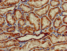 HAO2 Antibody in Immunohistochemistry (Paraffin) (IHC (P))
