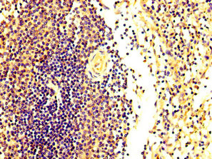 FASTKD2 Antibody in Immunohistochemistry (Paraffin) (IHC (P))