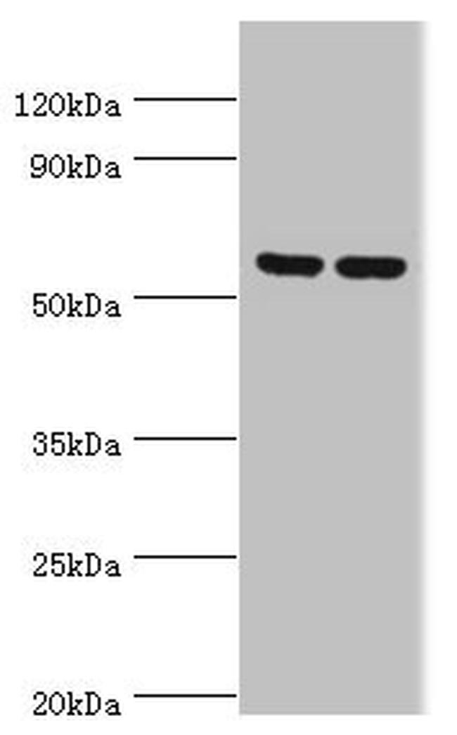 AMPK gamma-3 Antibody in Western Blot (WB)