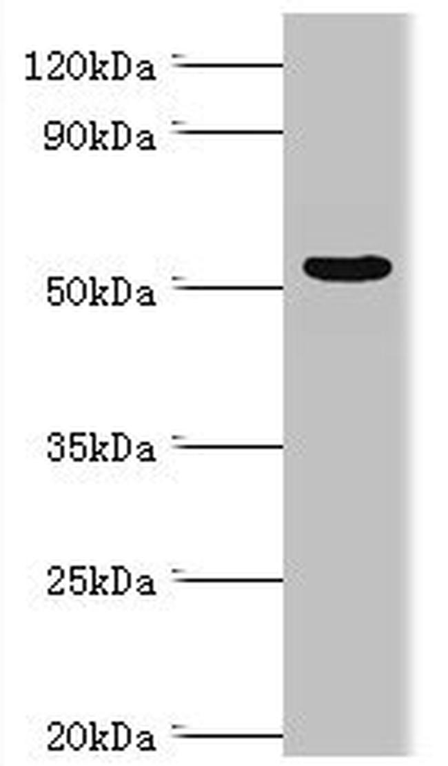 AMPK gamma-3 Antibody in Western Blot (WB)