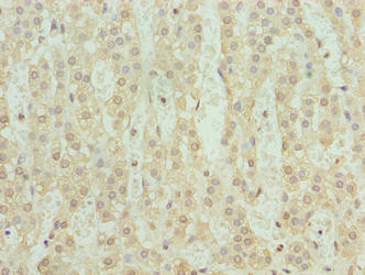 SERTAD1 Antibody in Immunohistochemistry (Paraffin) (IHC (P))