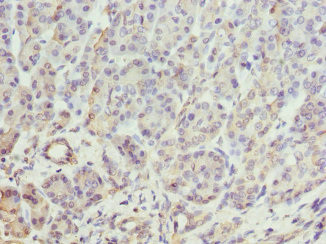 BTNL2 Antibody in Immunohistochemistry (Paraffin) (IHC (P))