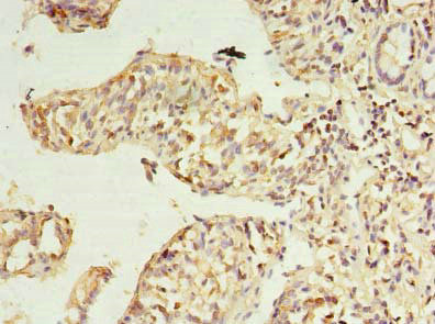 RWDD2A Antibody in Immunohistochemistry (Paraffin) (IHC (P))