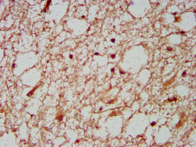 HOXD1 Antibody in Immunohistochemistry (Paraffin) (IHC (P))
