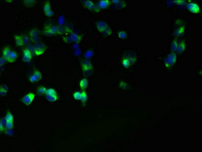 FAM118A Antibody in Immunocytochemistry (ICC/IF)