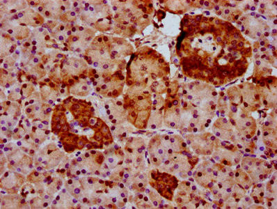 GLTSCR2 Antibody in Immunohistochemistry (Paraffin) (IHC (P))