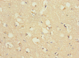 CHRNA9 Antibody in Immunohistochemistry (Paraffin) (IHC (P))