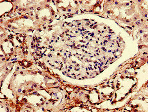 Rtp3 Antibody in Immunohistochemistry (Paraffin) (IHC (P))