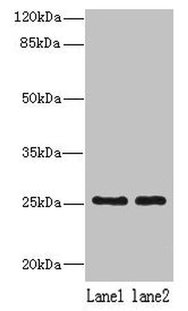 NDFIP1 Antibody in Western Blot (WB)