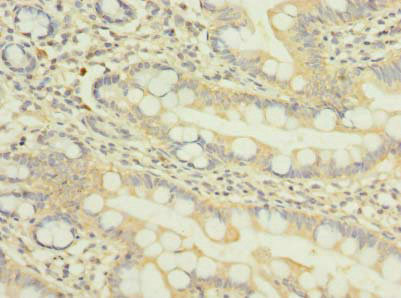 NUPL1 Antibody in Immunohistochemistry (Paraffin) (IHC (P))