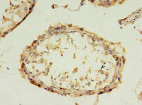 FGFBP2 Antibody in Immunohistochemistry (Paraffin) (IHC (P))