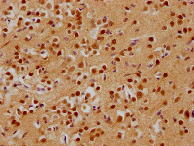 ADNP Antibody in Immunohistochemistry (Paraffin) (IHC (P))