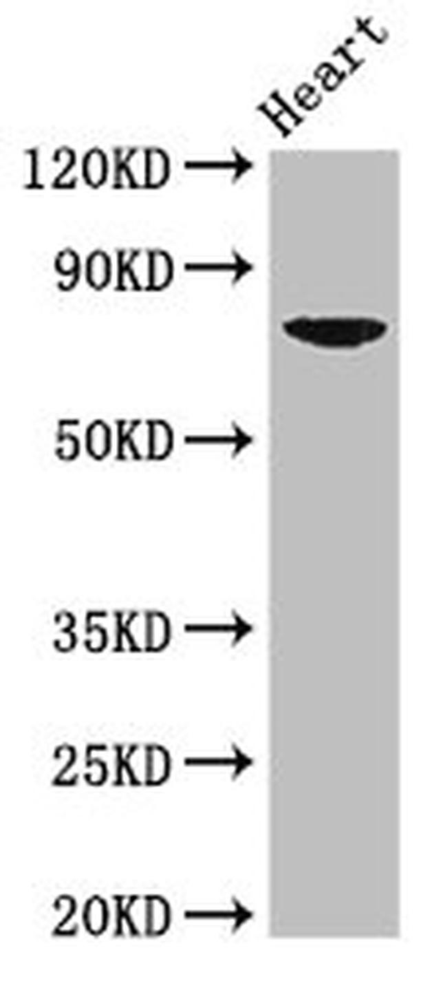 PRDM13 Antibody in Western Blot (WB)