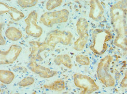 BRD9 Antibody in Immunohistochemistry (Paraffin) (IHC (P))