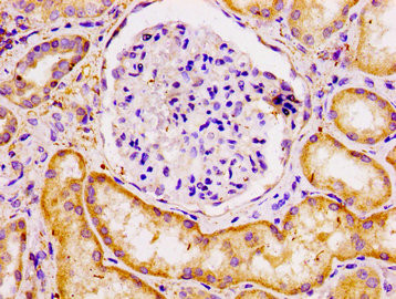 ECT2 Antibody in Immunohistochemistry (Paraffin) (IHC (P))