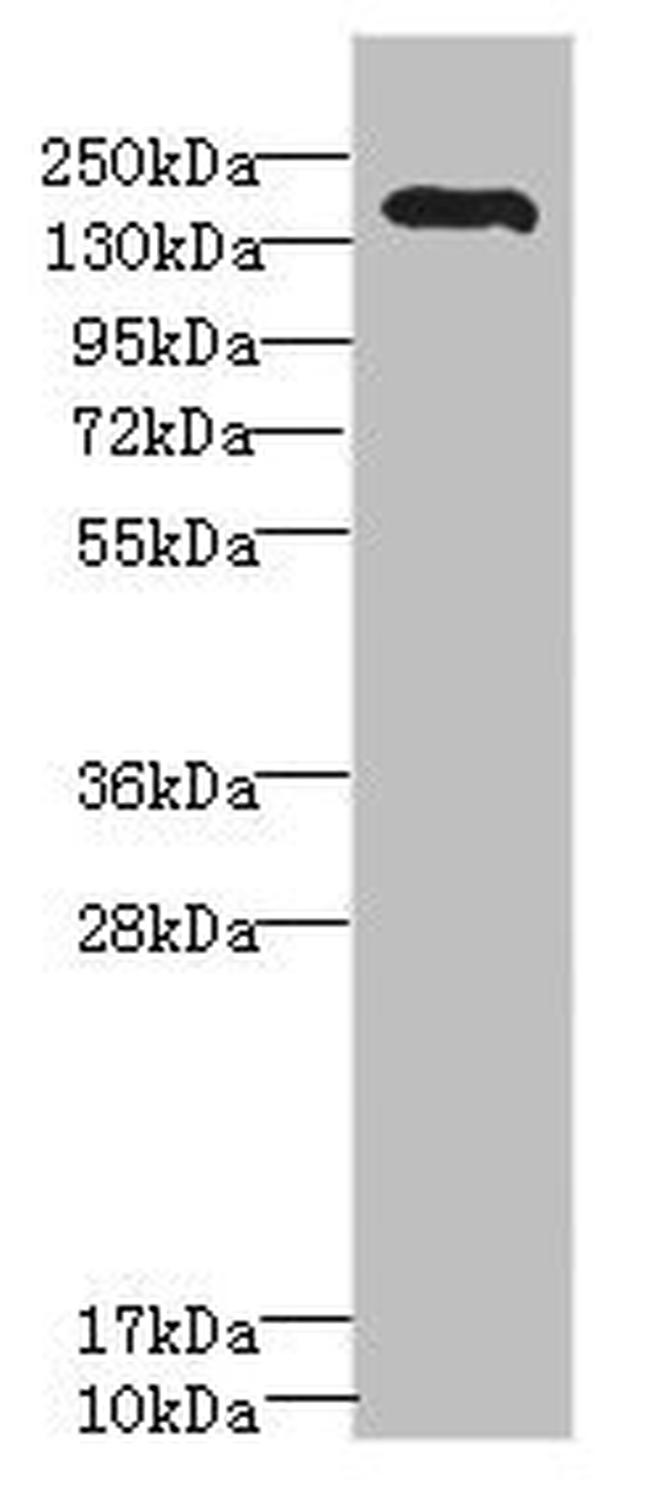 ROBO2 Antibody in Western Blot (WB)