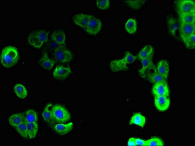 mPR gamma Antibody in Immunocytochemistry (ICC/IF)