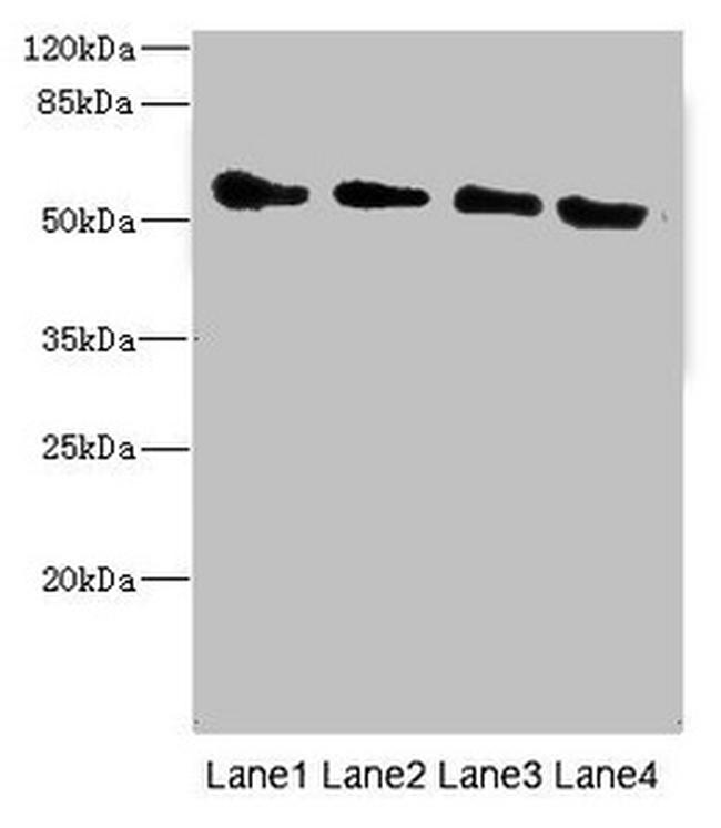 TRHDE Antibody in Western Blot (WB)