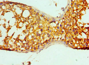 Doppel Antibody in Immunohistochemistry (Paraffin) (IHC (P))