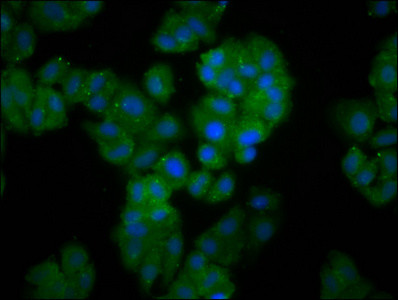 FBXO10 Antibody in Immunocytochemistry (ICC/IF)