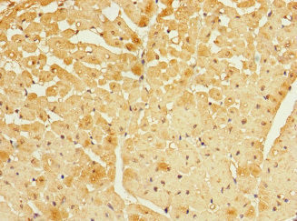 FBXO4 Antibody in Immunohistochemistry (Paraffin) (IHC (P))