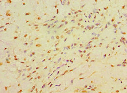 CA14 Antibody in Immunohistochemistry (Paraffin) (IHC (P))