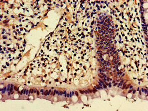 AJAP1 Antibody in Immunohistochemistry (Paraffin) (IHC (P))