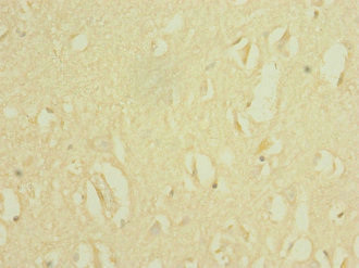 SCN8A Antibody in Immunohistochemistry (Paraffin) (IHC (P))
