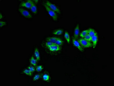C3orf18 Antibody in Immunocytochemistry (ICC/IF)