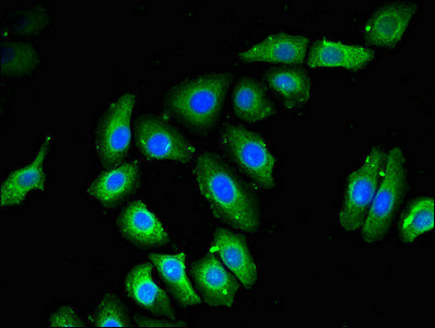 NOB1 Antibody in Immunocytochemistry (ICC/IF)