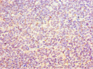 ORC6 Antibody in Immunohistochemistry (Paraffin) (IHC (P))