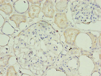 TIMM10B Antibody in Immunohistochemistry (Paraffin) (IHC (P))