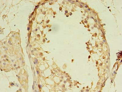 MORC2 Antibody in Immunohistochemistry (Paraffin) (IHC (P))