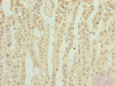 TPRKB Antibody in Immunohistochemistry (Paraffin) (IHC (P))