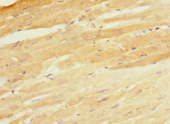 CBY1 Antibody in Immunohistochemistry (Paraffin) (IHC (P))