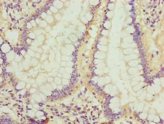 LRRC42 Antibody in Immunohistochemistry (Paraffin) (IHC (P))