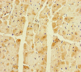 CORIN Antibody in Immunohistochemistry (Paraffin) (IHC (P))
