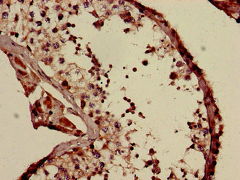 COQ6 Antibody in Immunohistochemistry (Paraffin) (IHC (P))