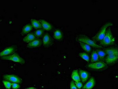 DRG1 Antibody in Immunocytochemistry (ICC/IF)