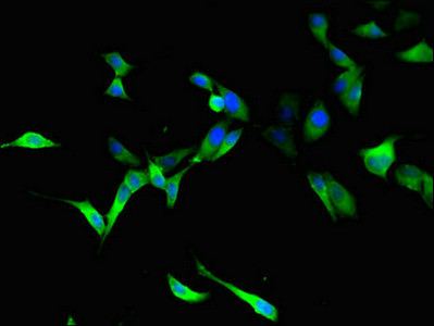 RTCB Antibody in Immunocytochemistry (ICC/IF)