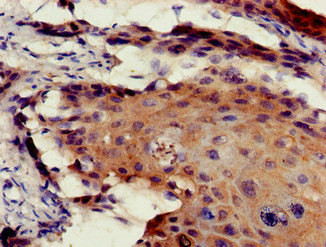 ETV7 Antibody in Immunohistochemistry (Paraffin) (IHC (P))