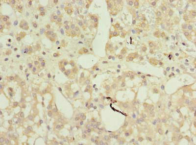 AP4B1 Antibody in Immunohistochemistry (Paraffin) (IHC (P))